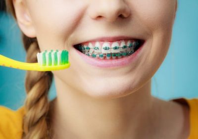 What is Orthodontics?